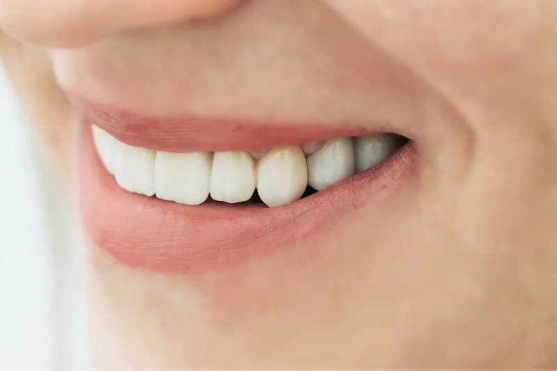 טיפול כתר זירקוניה - מרפאת שיניים באשדוד