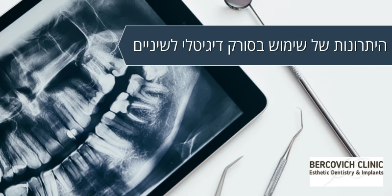 Read more about the article היתרונות של שימוש בסורק דיגיטלי לשיניים