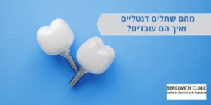 מהם שתלים דנטליים | מרפאה דיגיטלית חיים ברקוביץ'