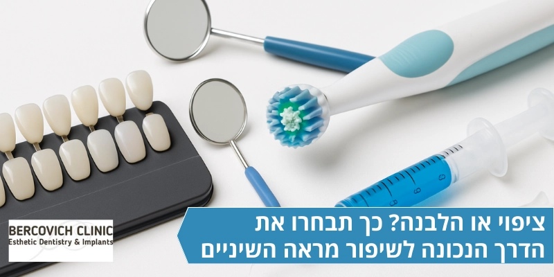 ציפוי או הלבנה- כך תבחרו את הדרך הנכונה לשיפור מראה השיניים